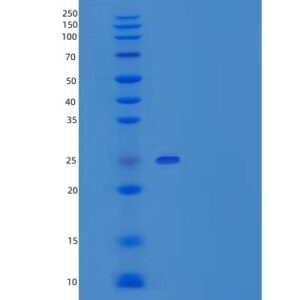 Human MAD2L1 (Mitotic Spindle Assembly Checkpoint Protein Mad2A) - Recombinant Protein