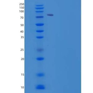 Human AACS (Acetoacetyl-Coa Synthetase) - Recombinant Protein