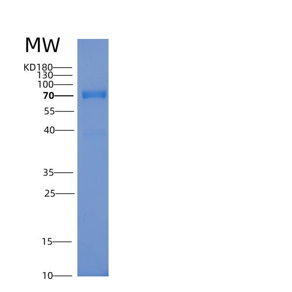 Human RPS6KB1 (Ribosomal Protein S6 Kinase Beta-1) - Recombinant Protein