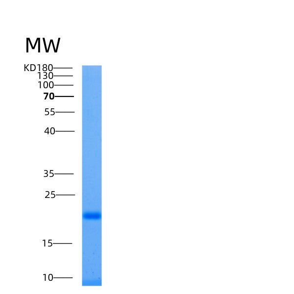 Human UBE2L6 (Ubiquitin/Isg15-Conjugating Enzyme E2 L6) - Recombinant Protein