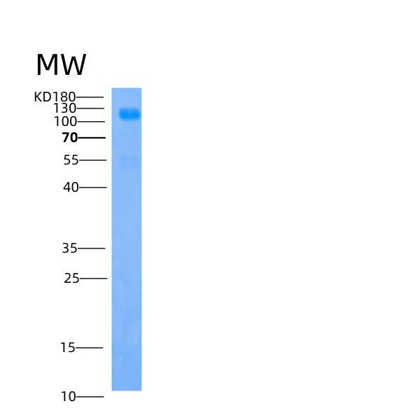 Human IGSF3 (Immunoglobulin Superfamily Member 3) - Recombinant Protein
