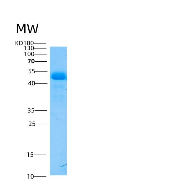 Mouse Smpdl3a (Cyclic Gmp-Amp Phosphodiesterase Smpdl3A) - Recombinant Protein