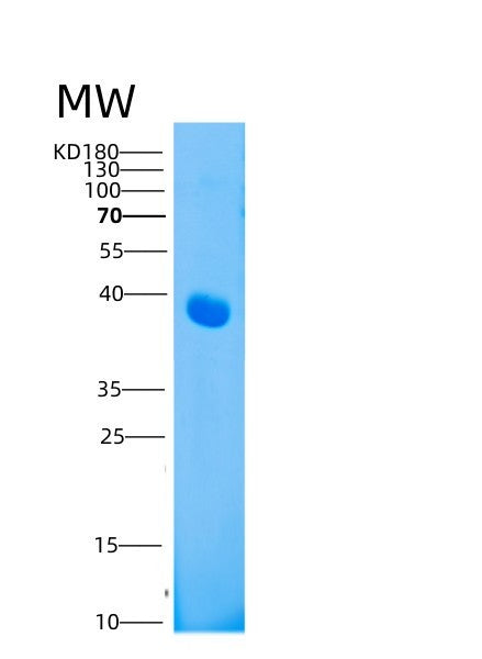 Human LAMP3 (Lysosome-Associated Membrane Glycoprotein 3) - Recombinant Protein