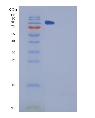 Mouse Chl1 (Neural Cell Adhesion Molecule L1-Like Protein) - Recombinant Protein