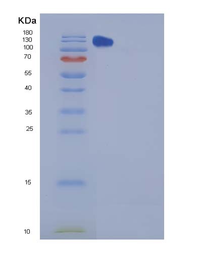 Mouse Chl1 (Neural Cell Adhesion Molecule L1-Like Protein) - Recombinant Protein