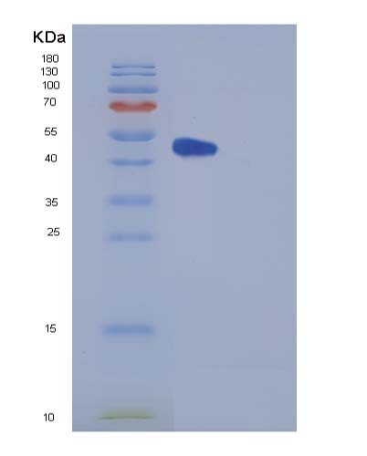 Human CPE (Carboxypeptidase E) - Recombinant Protein