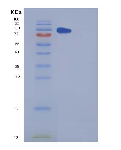 Human CPE (Carboxypeptidase E) - Recombinant Protein