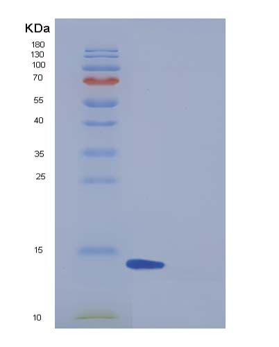 Human FABP6 (Gastrotropin) - Recombinant Protein