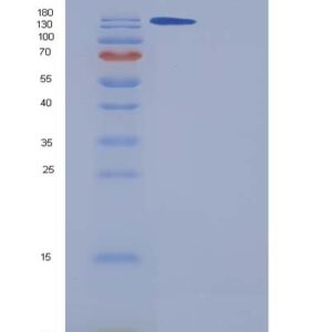 Human A2M (Alpha-2-Macroglobulin) - Recombinant Protein