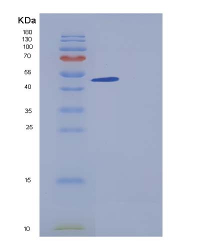 Human PXYLP1 (2-Phosphoxylose Phosphatase 1) - Recombinant Protein