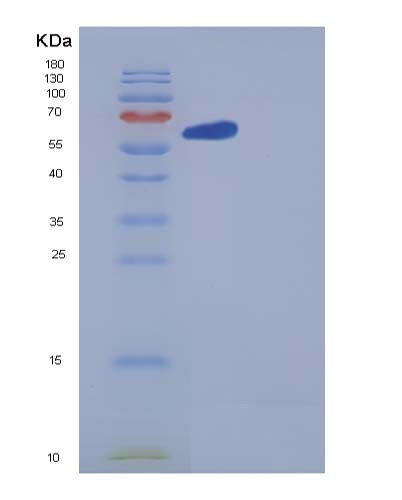 Human GBP1 (Guanylate-Binding Protein 1) - Recombinant Protein