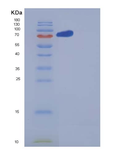 Human NRP2 (Neuropilin-2) - Recombinant Protein