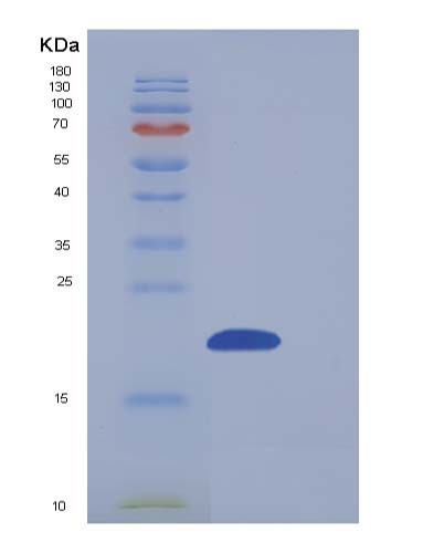 Human NUDT2 (Bis(5'-Nucleosyl)-Tetraphosphatase [Asymmetrical]) - Recombinant Protein