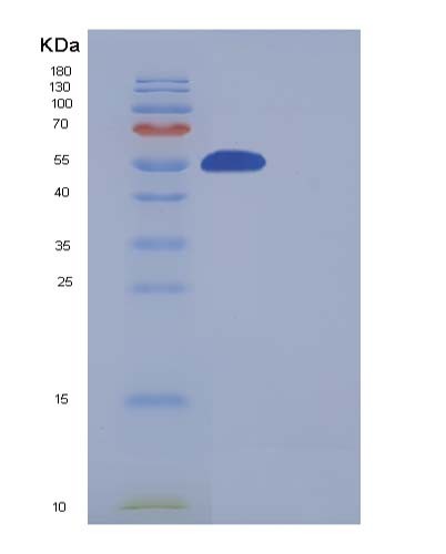 Human SMYD3 (Histone-Lysine N-Methyltransferase Smyd3) - Recombinant Protein