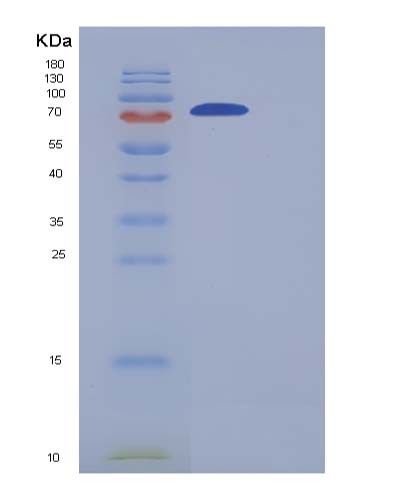 Human COLGALT2 (Procollagen Galactosyltransferase 2) - Recombinant Protein