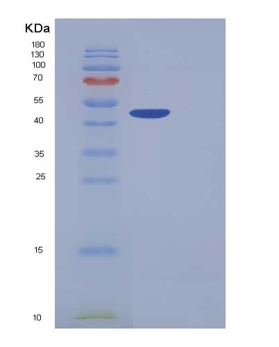 Human CPB1 (Carboxypeptidase B) - Recombinant Protein