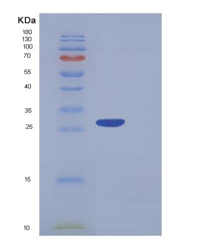 Human PF4V1 (Platelet Factor 4 Variant) - Recombinant Protein