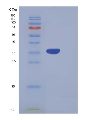 Human PRRG2 (Transmembrane Gamma-Carboxyglutamic Acid Protein 2) - Recombinant Protein