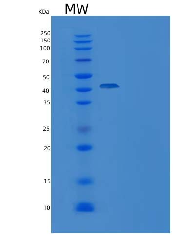 Human C1D (Nuclear Nucleic Acid-Binding Protein C1D) - Recombinant Protein