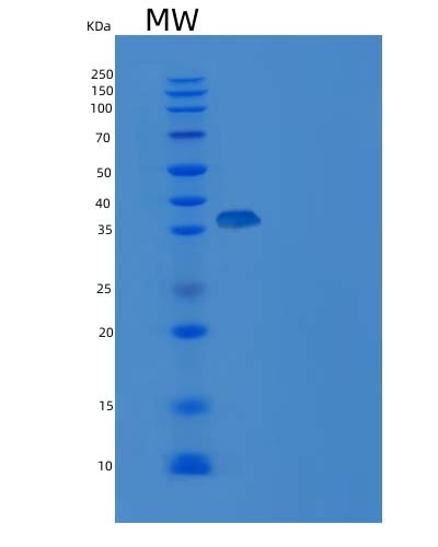 Mouse Cd3e (T-Cell Surface Glycoprotein Cd3 Epsilon Chain) - Recombinant Protein