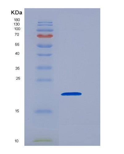 Mouse Cd8a (T-Cell Surface Glycoprotein Cd8 Alpha Chain) - Recombinant Protein