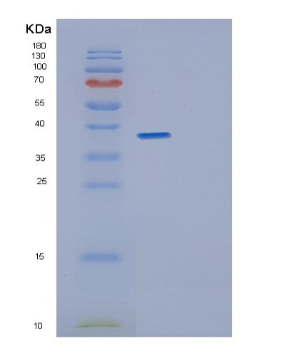 Human GET4 (Golgi To Er Traffic Protein 4 Homolog) - Recombinant Protein