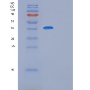 Human GFRA3 (Gdnf Family Receptor Alpha-3) - Recombinant Protein