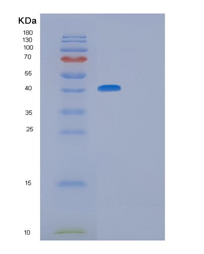 Human GFRA3 (Gdnf Family Receptor Alpha-3) - Recombinant Protein