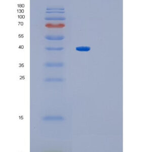 Human GYG1 (Glycogenin-1) - Recombinant Protein