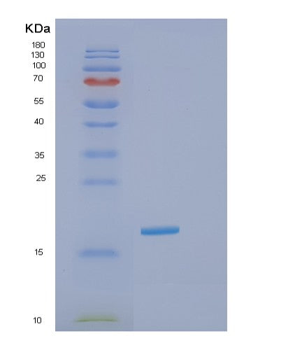 Human GOLGA7 (Golgin Subfamily A Member 7) - Recombinant Protein