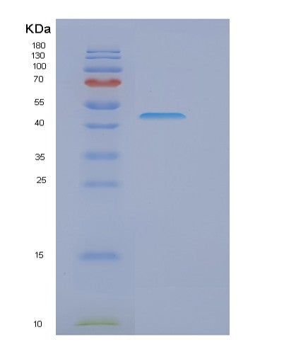 Human GORASP2 (Golgi Reassembly-Stacking Protein 2) - Recombinant Protein