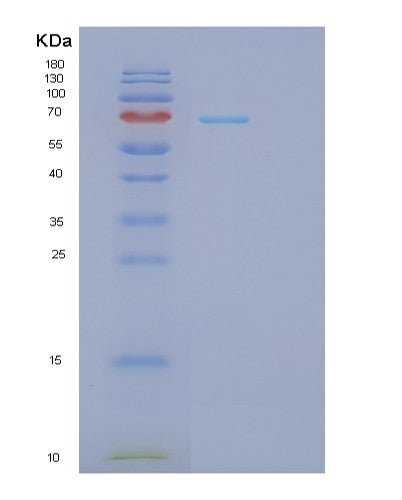 Human GPI (Glucose-6-Phosphate Isomerase) - Recombinant Protein