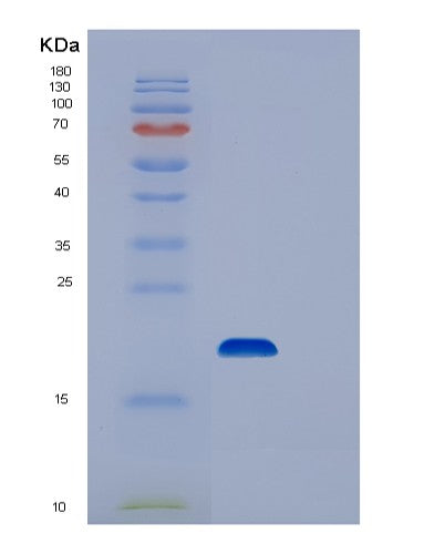 Human UBE2I (Sumo-Conjugating Enzyme Ubc9) - Recombinant Protein