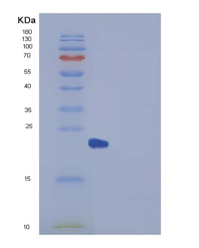 Human UBE2H (Ubiquitin-Conjugating Enzyme E2 H) - Recombinant Protein