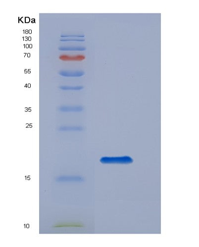 Human CD14 (Monocyte Differentiation Antigen Cd14) - Recombinant Protein