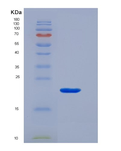 Human CD3G (T-Cell Surface Glycoprotein Cd3 Gamma Chain) - Recombinant Protein