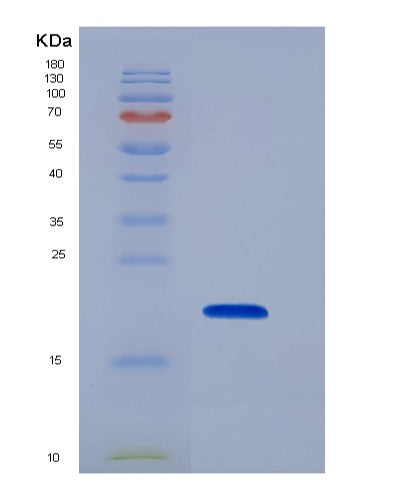 Human CD59 (Cd59 Glycoprotein) - Recombinant Protein