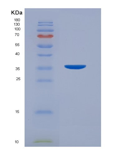 Human CD7 (T-Cell Antigen Cd7) - Recombinant Protein