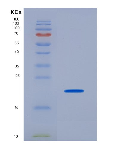 Human CD74 (Hla Class Ii Histocompatibility Antigen Gamma Chain) - Recombinant Protein