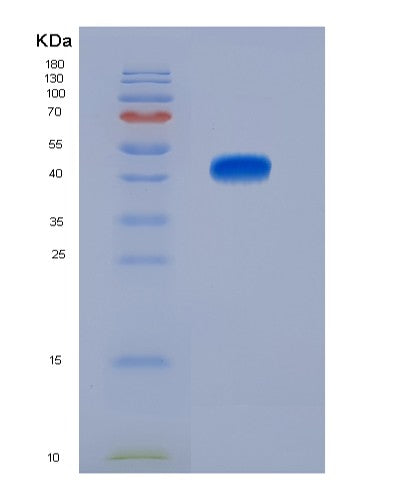 Human CD74 (Hla Class Ii Histocompatibility Antigen Gamma Chain) - Recombinant Protein