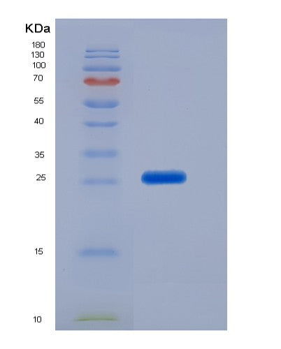 Human CD79B (B-Cell Antigen Receptor Complex-Associated Protein Beta Chain) - Recombinant Protein