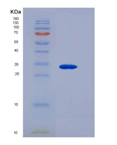 Human CD79B (B-Cell Antigen Receptor Complex-Associated Protein Beta Chain) - Recombinant Protein