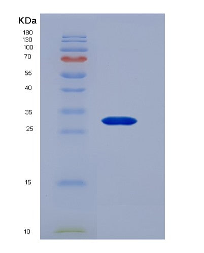 Human CNTF (Ciliary Neurotrophic Factor) - Recombinant Protein