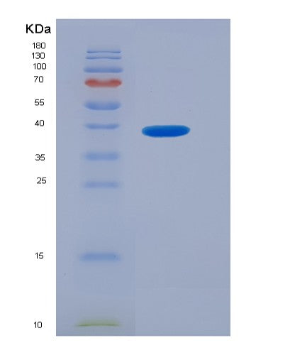 Human CX3CL1 (Fractalkine) - Recombinant Protein