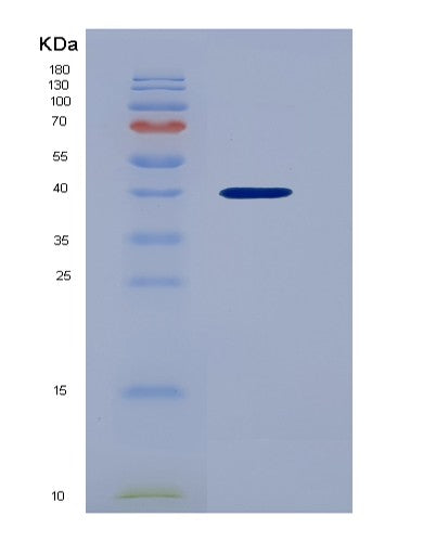 Human CXCL1 (Growth-Regulated Alpha Protein) - Recombinant Protein
