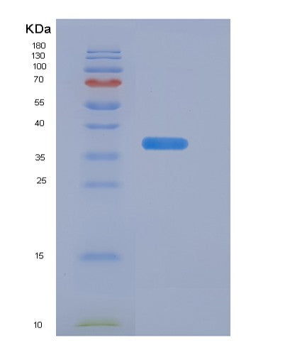 Human EGFR (Epidermal Growth Factor Receptor) - Recombinant Protein