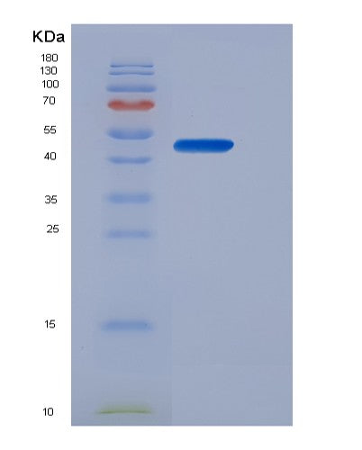 Human EPO (Erythropoietin) - Recombinant Protein