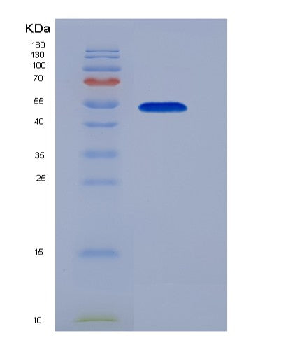Human EPOR (Erythropoietin Receptor) - Recombinant Protein