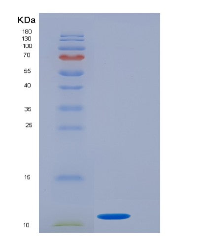 Human GTF2H5 (General Transcription Factor Iih Subunit 5) - Recombinant Protein