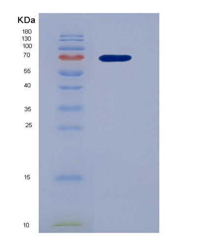Human HGF (Hepatocyte Growth Factor) - Recombinant Protein